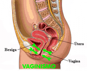 contraccion de la musculatura vaginal